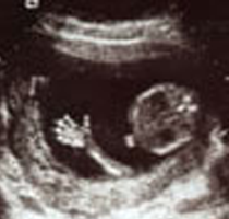 Baby waving in ultrasound image