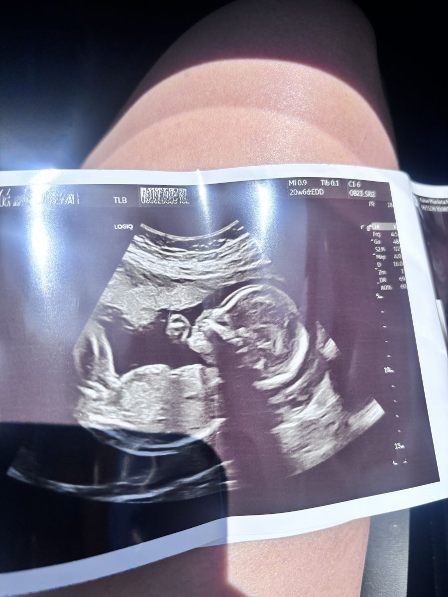 Andres, born 2026