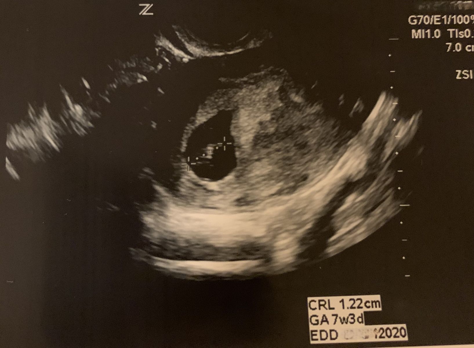 Luis, Born 2020