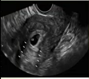 Artifact image