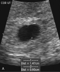US2026Picture1a